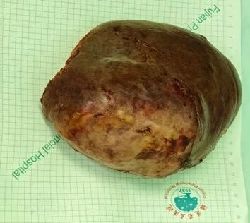 da5ddf6d-cd7f-4005-919a-8db93ee5d8d1 da5ddf6d-cd7f-4005-919a-8db93ee5d8d1